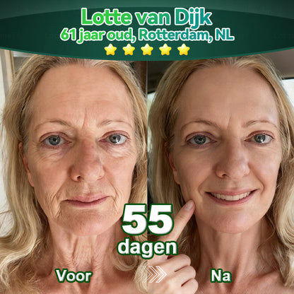 (Officieel gecertificeerde winkel) Lotmay® Stamcel‑Collageenpeptide Orale Druppels 💕 (Verstevigt en lift verslapte huid · Vermindert zichtbaar rimpels)