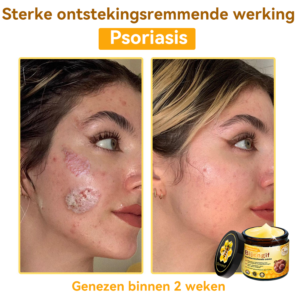 2 Kruiken (✨Meest geselecteerd✨)