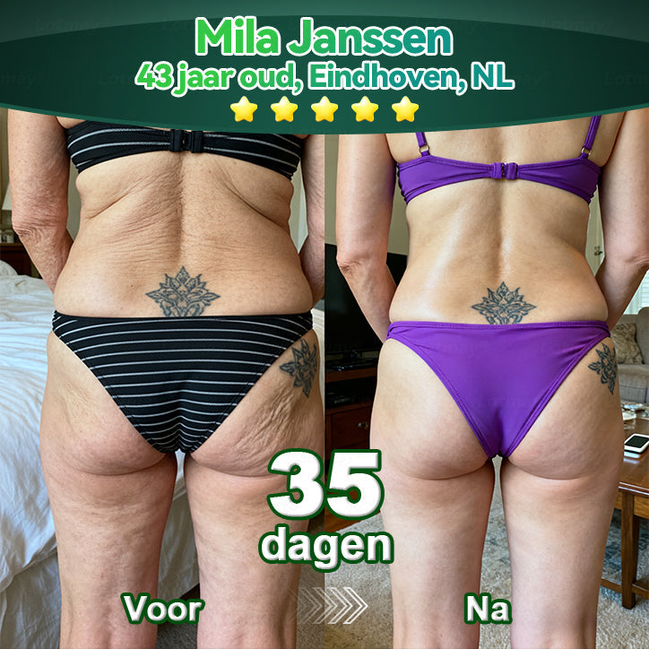 (Officieel gecertificeerde winkel) Lotmay® Stamcel‑Collageenpeptide Orale Druppels 💕 (Verstevigt en lift verslapte huid · Vermindert zichtbaar rimpels)