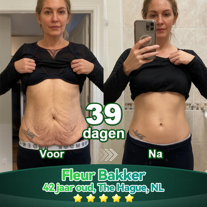 (Officieel gecertificeerde winkel) Lotmay® Stamcel‑Collageenpeptide Orale Druppels 💕 (Verstevigt en lift verslapte huid · Vermindert zichtbaar rimpels)
