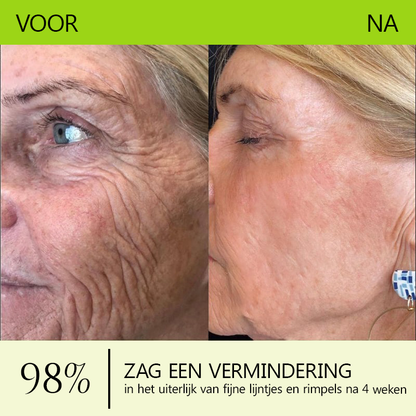 （Officiële winkel）💖STDEI® Botox & Vitamine-A-Retinol Shot Anti-Rimpel Verstevigingscrème - Nu 50% korting in de eindejaarsuitverkoop!🔥