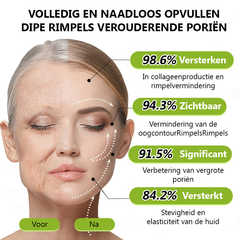 （Officiële winkel）💖STDEI® Botox & Vitamine-A-Retinol Shot Anti-Rimpel Verstevigingscrème - Nu 50% korting in de eindejaarsuitverkoop!🔥
