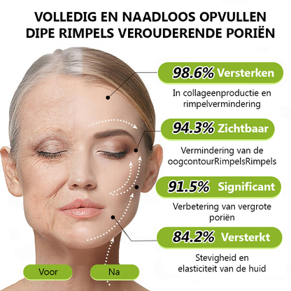 （Officiële winkel）💖STDEI® Botox & Vitamine-A-Retinol Shot Anti-Rimpel Verstevigingscrème - Nu 50% korting in de eindejaarsuitverkoop!🔥