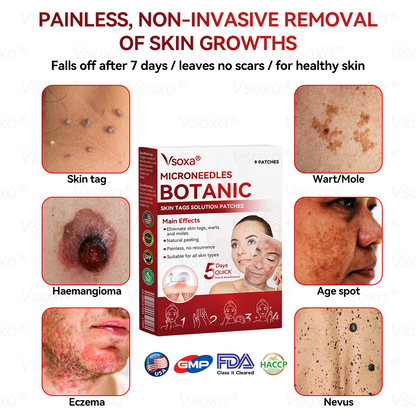 𝑉𝑠𝑜𝑥𝑎® 💧 Microneedling Plantaardige Oplossing voor Huidtags Patches 👩‍⚕️