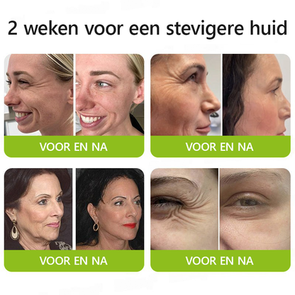（Officiële winkel）💖STDEI® Botox & Vitamine-A-Retinol Shot Anti-Rimpel Verstevigingscrème - Nu 50% korting in de eindejaarsuitverkoop!🔥