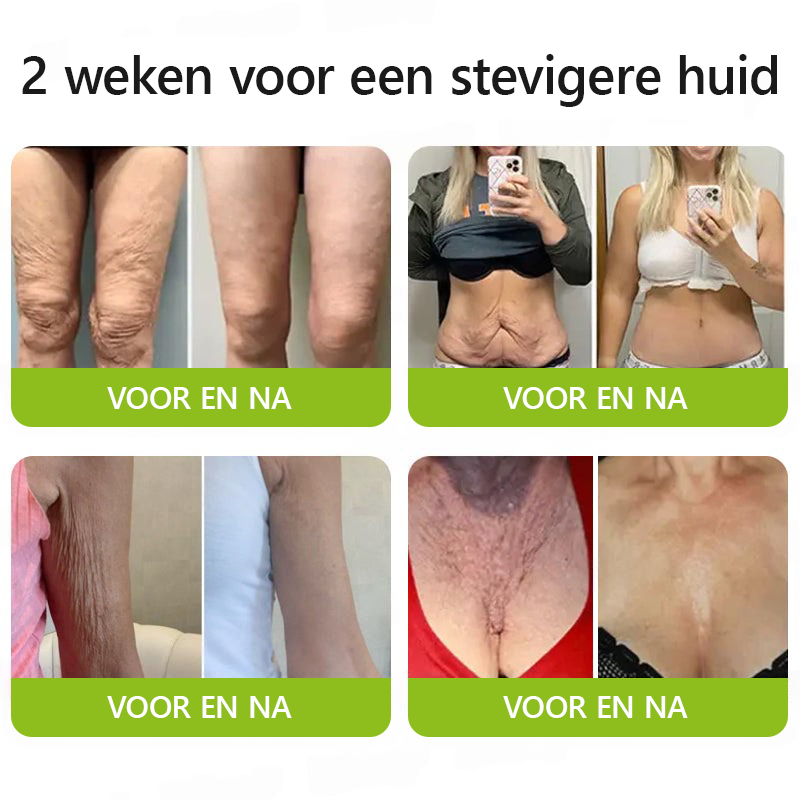 （Officiële winkel）💖STDEI® Botox & Vitamine-A-Retinol Shot Anti-Rimpel Verstevigingscrème - Nu 50% korting in de eindejaarsuitverkoop!🔥