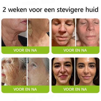 （Officiële winkel）💖STDEI® Botox & Vitamine-A-Retinol Shot Anti-Rimpel Verstevigingscrème - Nu 50% korting in de eindejaarsuitverkoop!🔥